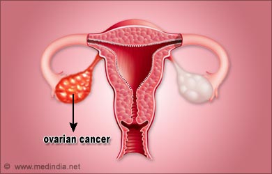 This image has an empty alt attribute; its file name is moringa-ovarian-cancer-image-www.sunblestproducts.com_.jpg